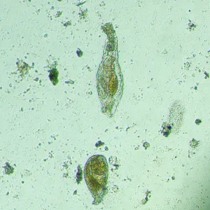 Микроскоп биологический инвертированный цифровой MAGUS Bio VD300 LCD, изображение 21