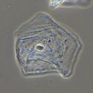 Фазово-контрастное устройство MAGUS SPH2, изображение 16